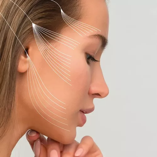 fils-tenseurs visage - rajeunissement.webp